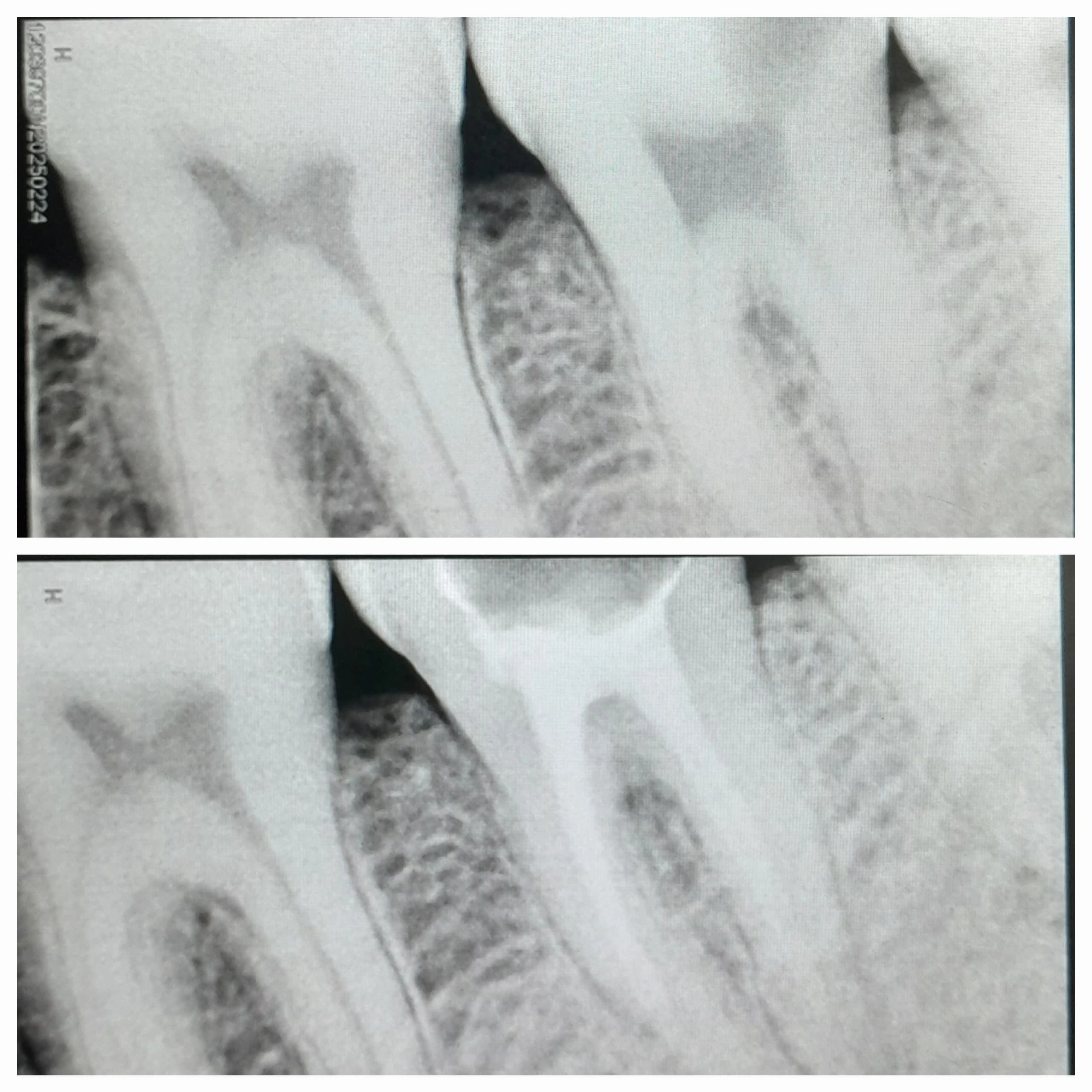 Dental X-ray done at Sterling Dental Clinic